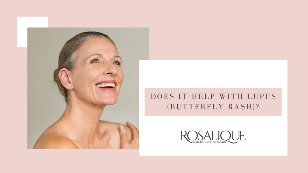 Does Rosalique help with lupus (butterfly rash)?