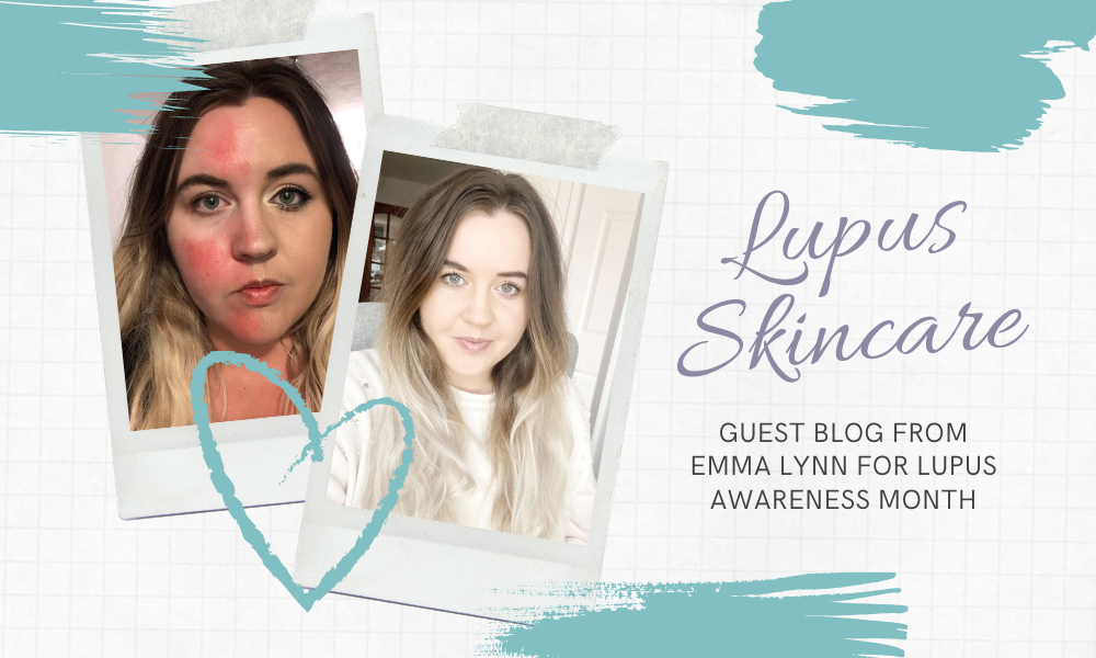 Lupus Skincare Tips from Emma Lynn – Lupus Awareness Month
